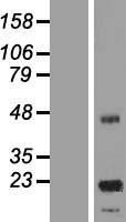 NBL1-12619 - ASPDH Lysate