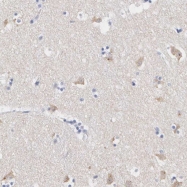 NBP1-83461 - ASPHD2