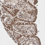 NBP1-82980 - Astrotactin-2