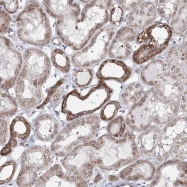 NBP1-82228 - ATAD1