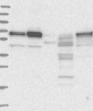 NBP1-85872 - ATE1