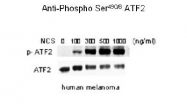 NB300-257 - ATF2