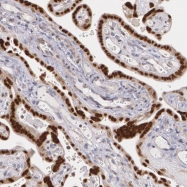 NBP1-85816 - ATF3