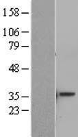 NBL1-07792 - ATF5 Lysate