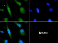 NBP1-75478 - ATF6 alpha