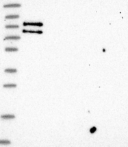 NBP1-91687 - ATF6 beta