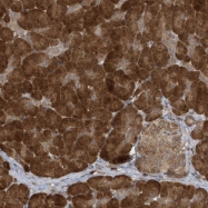 NBP1-89044 - Autophagin-2
