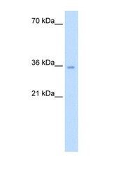 NBP1-56916 - ATIC / PURH