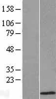 NBL1-07805 - ATOX1 Lysate