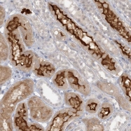 NBP1-88903 - ATP11A