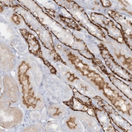 NBP1-88904 - ATP11A