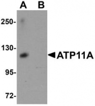 NBP1-77189 - ATP11A