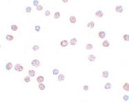 NBP1-77190 - ATP11B