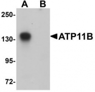 NBP1-77190 - ATP11B