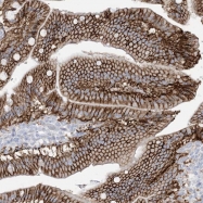 NBP1-88902 - ATP11C