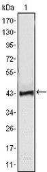 NBP1-47467 - ATP2C1