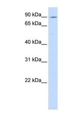NBP1-59031 - ATP2C1
