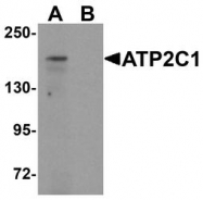 NBP1-76566 - ATP2C1