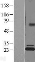 NBL1-07822 - ATP5F1 Lysate