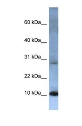NBP1-69248 - ATP5G2