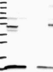 NBP1-88888 - ATPase subunit F6