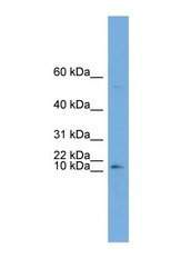 NBP1-59654 - ATP6V0C
