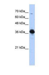 NBP1-54595 - ATP6V0D2