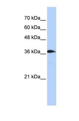 NBP1-54857 - ATP6V0D2