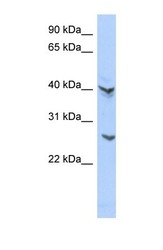 NBP1-55100 - ATP6V0E2