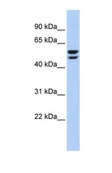 NBP1-54759 - ATP6V1B2