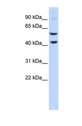 NBP1-54858 - ATP6V1B2