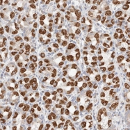 NBP1-88891 - ATP6V1C1