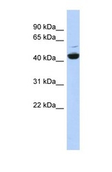 NBP1-54902 - ATP6V1C1