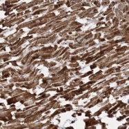 NBP1-88892 - ATP6V1C2