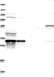 NBP1-88895 - ATP6V1D