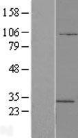 NBL1-07844 - ATP6V1E2 Lysate
