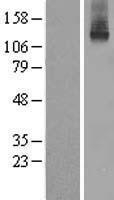 NBL1-07848 - ATP7b Lysate