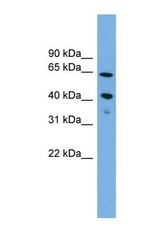 NBP1-57018 - ATP8B2