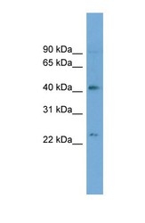 NBP1-57019 - ATP8B2