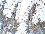 NBP1-54700 - ATP synthase subunit beta