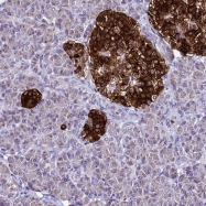NBP1-91691 - ATPBD4