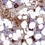NBP1-90070 - CARNS1 / ATPGD1