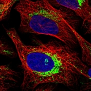NBP1-90069 - ATPase inhibitor ATPIF1