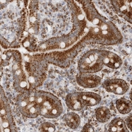 NBP1-90069 - ATPase inhibitor ATPIF1