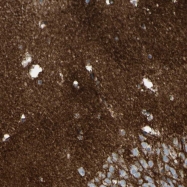 NBP1-90174 - ATP1B2
