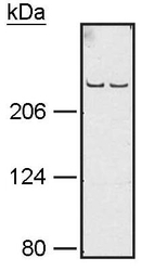 NB100-916 - ATR / FRP1