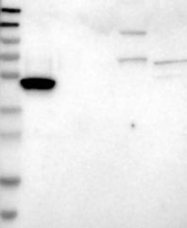 NBP1-90063 - Ataxin-2