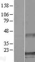 NBL1-07854 - ATXN7L1 Lysate