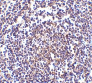 NBP1-76771 - AVEN