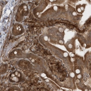 NBP1-80888 - AVP-induced protein 1